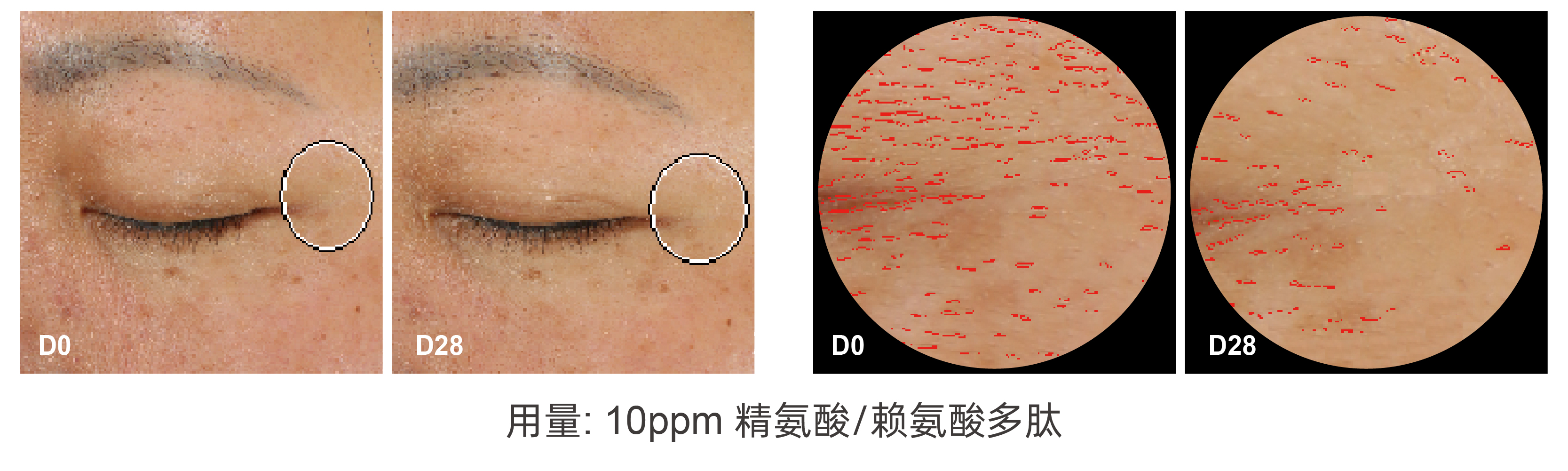 精氨酸/赖氨酸多肽