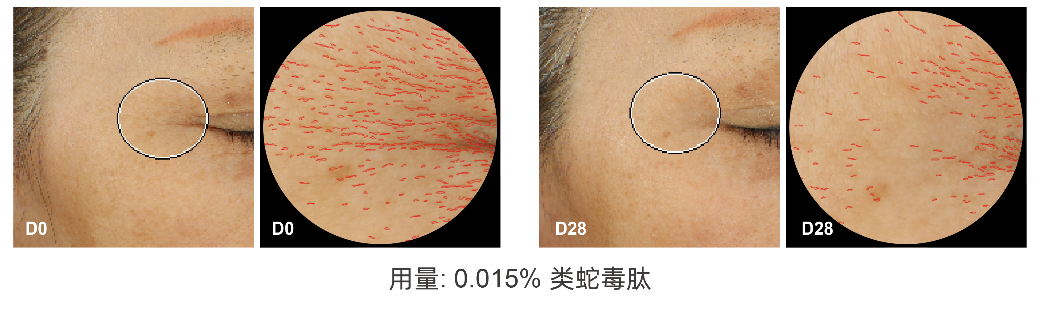 二肽二氨基丁酰苄基酰胺二乙酸盐