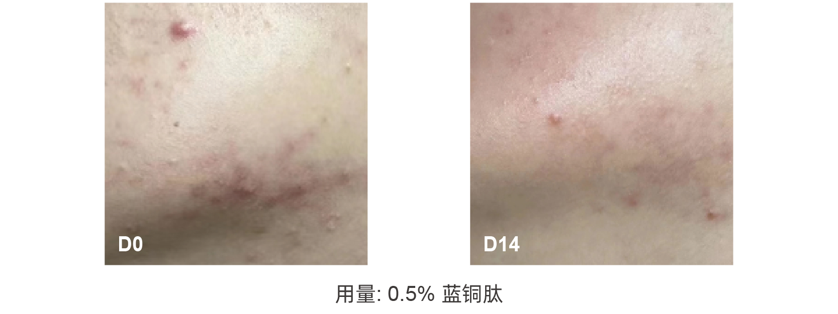 蓝铜肽
