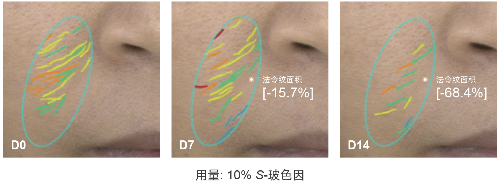 S-玻色因