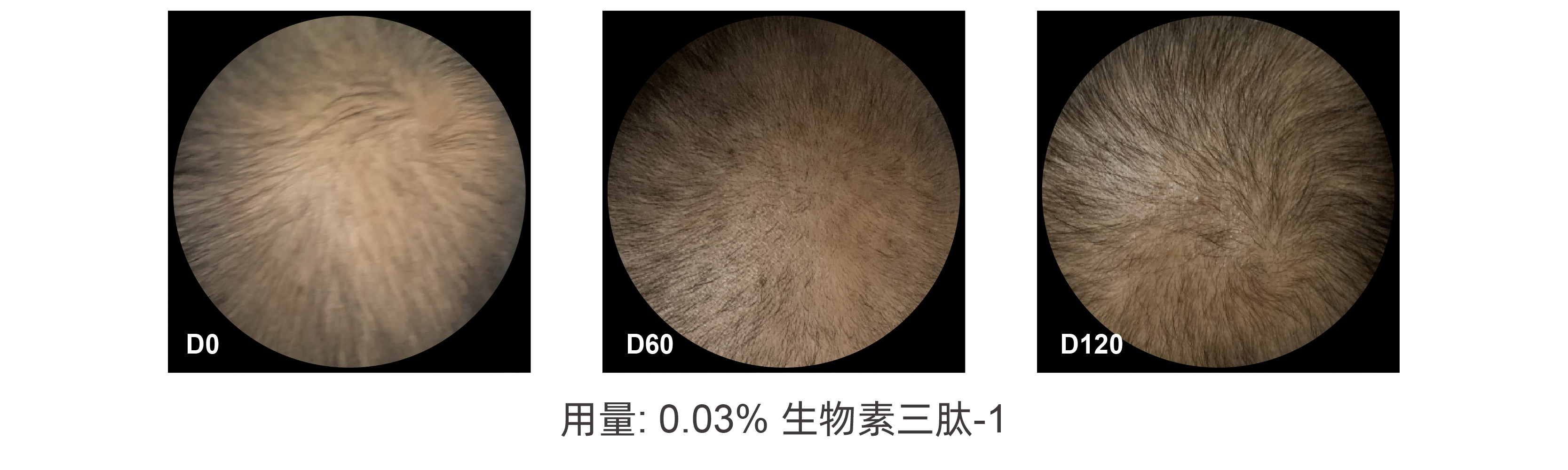 生物素三肽-1*